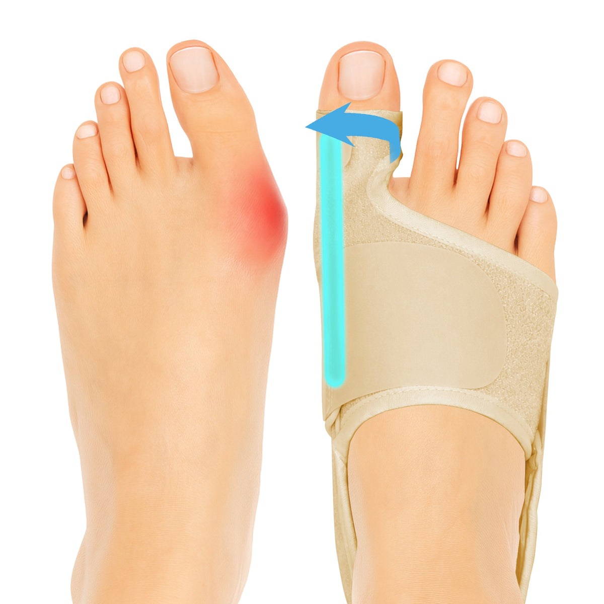 Color-​SPRING SEAON 2-Pack Women & Men Adjustable Big Toe Support - Day/Night Comfort Sleeve - SpringSeaon